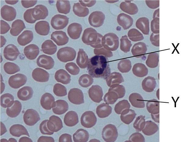 blood cell image